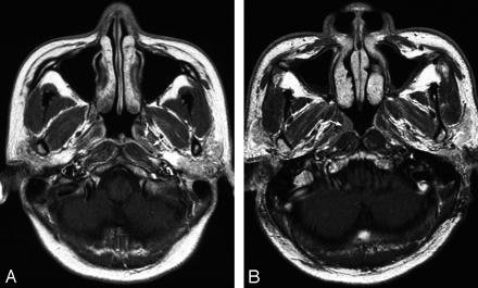 Fig 3.