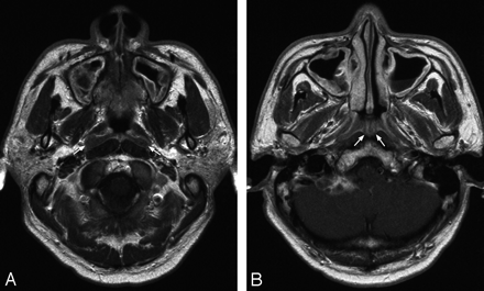 Fig 4.