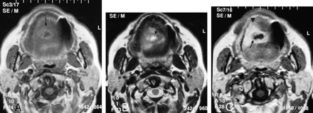 Fig 1.