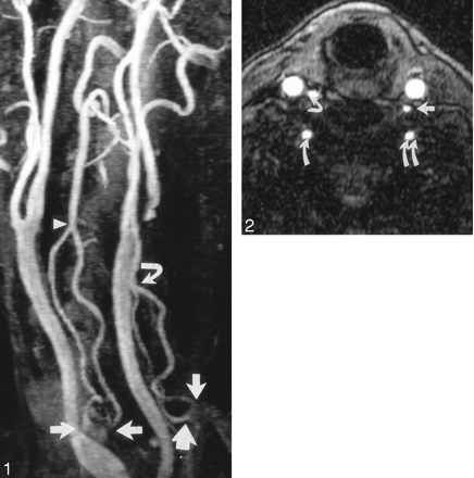 Fig 2.