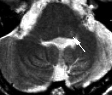 Fig 1.