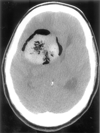 Fig 1.