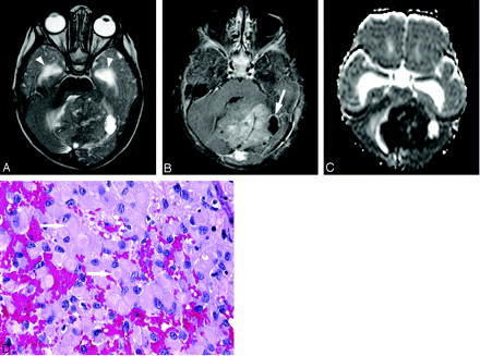 Fig 6.