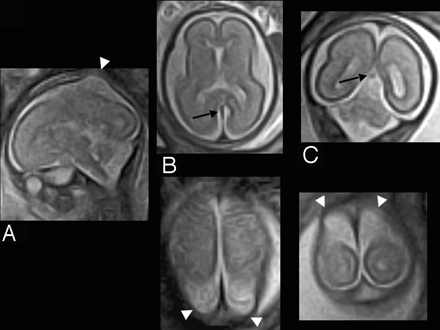 Fig 2.