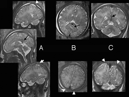 Fig 2.