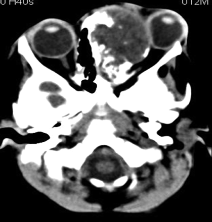 Fig 1.