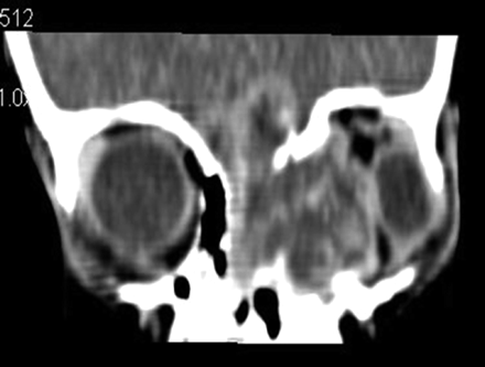 Fig 2.
