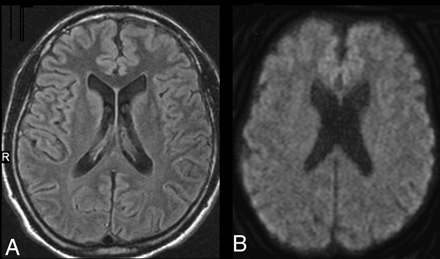 Fig 2.