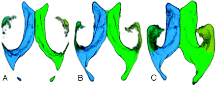 Fig 2.