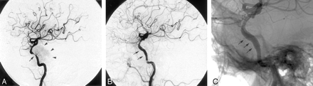Fig 2.