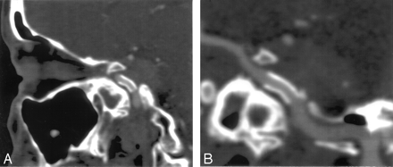 Fig 3.