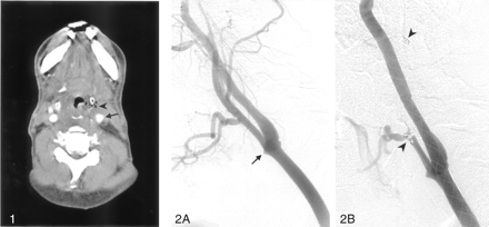 Fig 1.