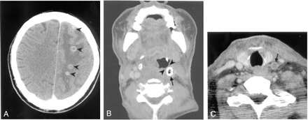 Fig 3.