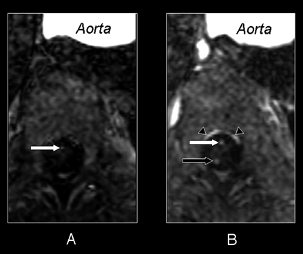 Fig 2.
