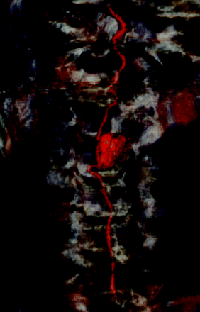 Fig 5.