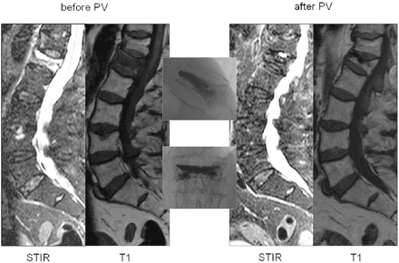 Fig 4.