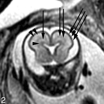 Fig 2.
