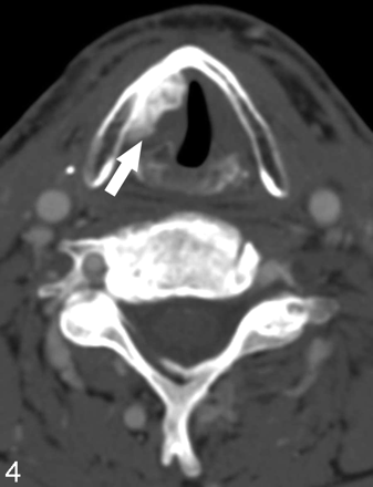 Fig 4.