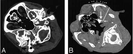 Fig 1.