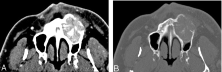 Fig 1.