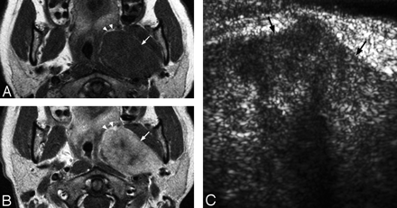 Fig 3.