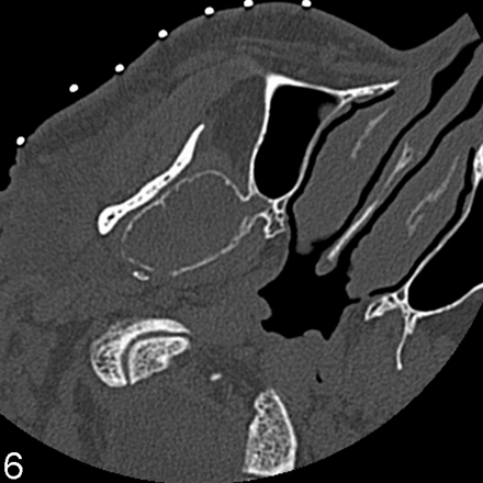 Fig. 6.