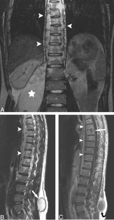 Fig 4.