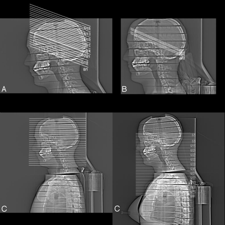 Fig 1.