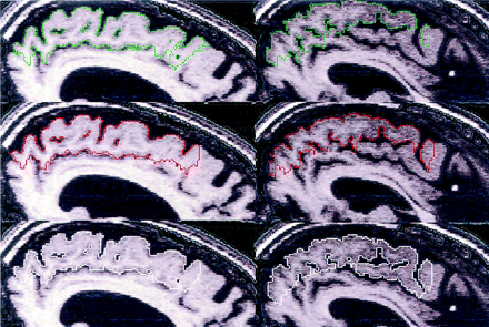 Fig 8.