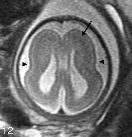 Fig 12.