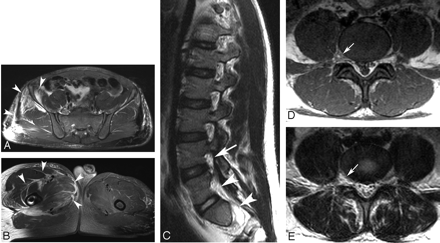 Fig 1.