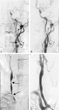 Fig 2.