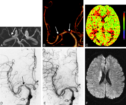 Fig 3.