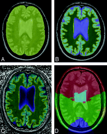Fig 1.