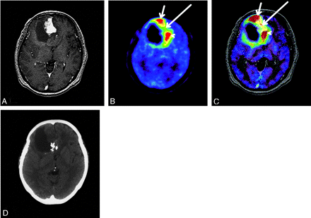 Fig 1.