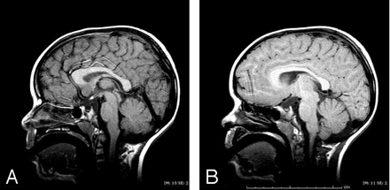 Fig 1.