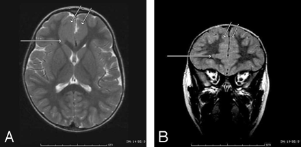 Fig 2.