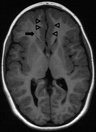   Fig 1. 