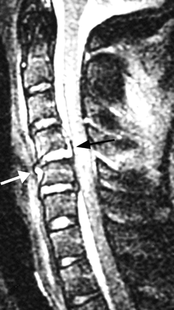 Fig 2.