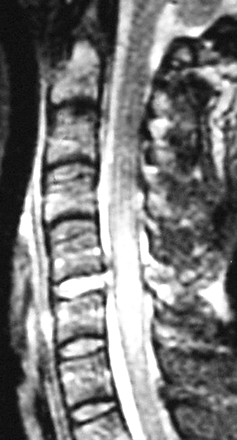 Fig 6.