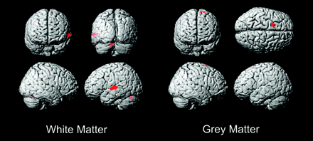 Fig 1.