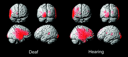 Fig 3.