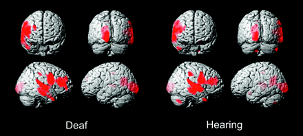 Fig 4.