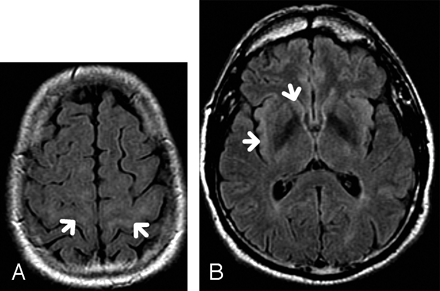 Fig 1.