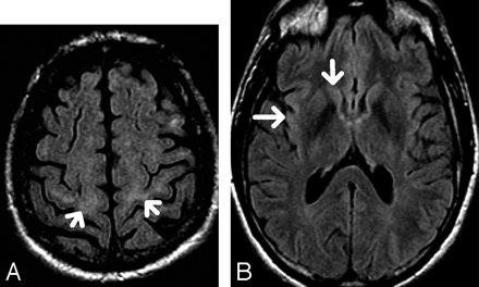 Fig 2.