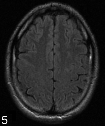 Fig 5.