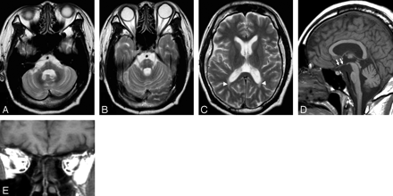   Fig 1. 