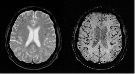   Fig 1. 