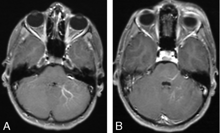Fig 2.