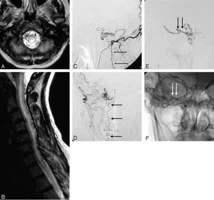 Fig 3.